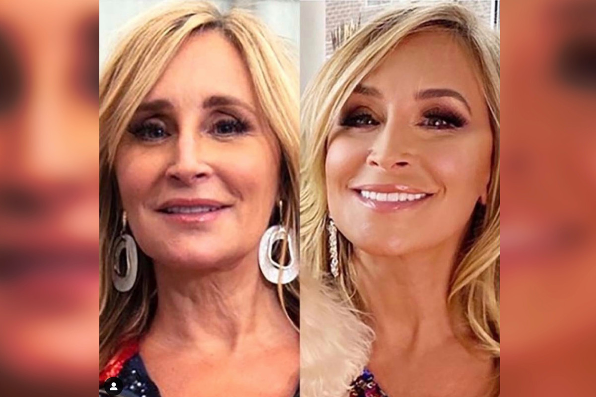 ‘RHONY’ Sonja Morgan pronkt met een lagere facelift en halslift